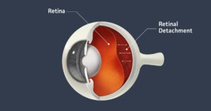 Eye Diagram - VE St Lucia