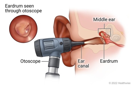 hearing Diagram with Scope - Vision Express Saint Lucia