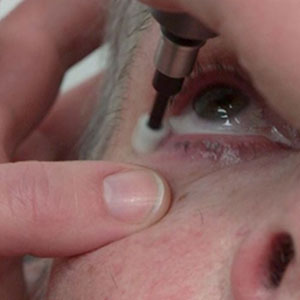 Vision Express Dry eye Treatment - Eye Spa